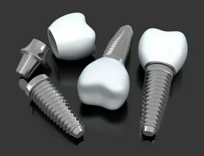 diş implant fiyatları