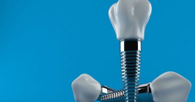 dentan implant