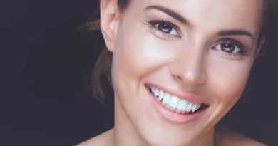 Alanya Hollywood Smile Makeover