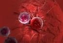 Ung thư và tỷ lệ sống sót